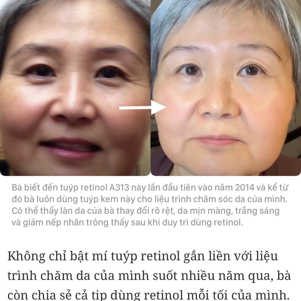 Kem A313 pommade 50g chống lão hóa giảm mụn Pháp