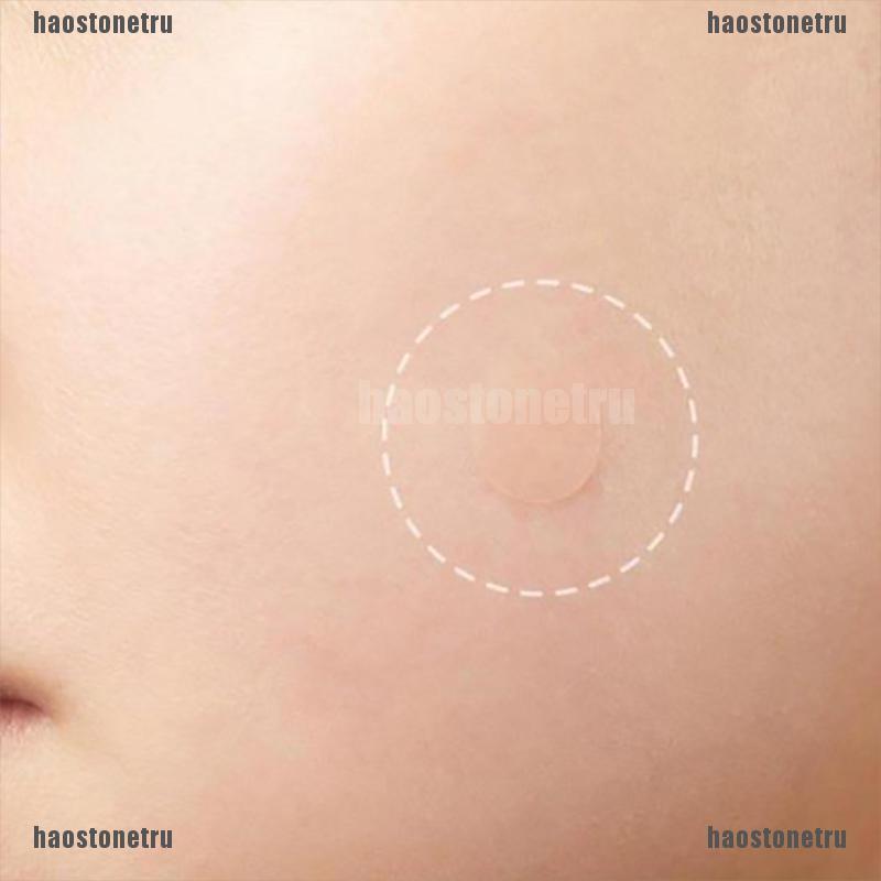 Bộ 36 Miếng Dán Mụn Hydrocolloid Và Mụn Trứng Cá