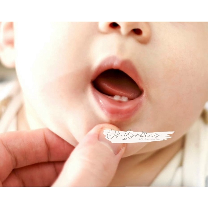 Gel bôi giảm đau khi bé mọc răng Detinox - nội địa Đức [OH BABIES]