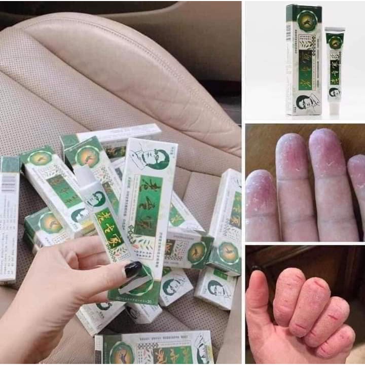 Kem bôi ngoài da chống nứt nẻ , bong chóc , khô da, nấm,vảy nến ,hắc lào CỰC HIỆU QUẢ - Mutech