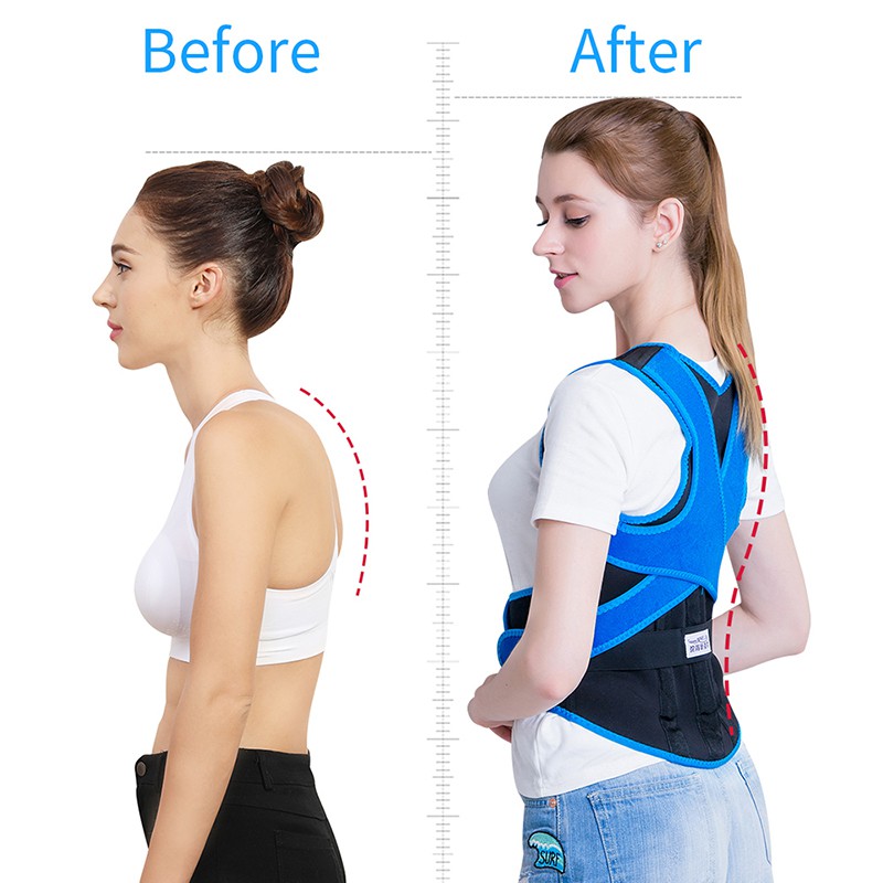 Đai Đeo Hỗ Trợ Điều Chỉnh Tư Thế Lưng Junlaikang Hiệu Quả