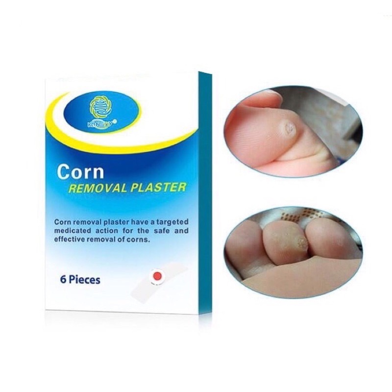 Miếng dán giảm mụn cóc Corn Removal Plaster Kangdy /T12/2023