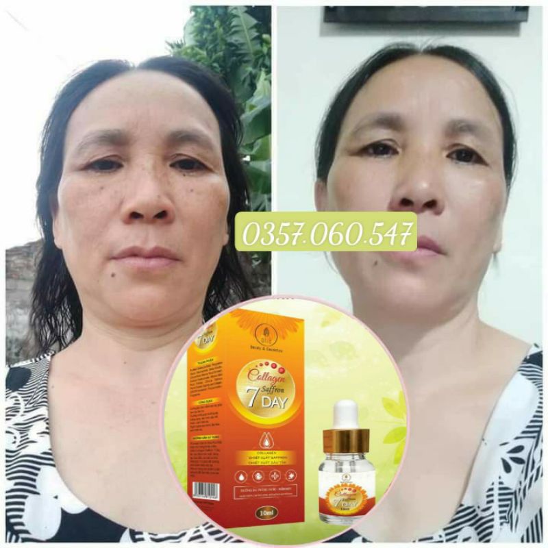 [Chính Hãng] SERUM COLLAGEN SAFFRON TÁI SINH 7 DAY OLIC (huyết thanh truyền trắng olic mẫu mới) | BigBuy360 - bigbuy360.vn