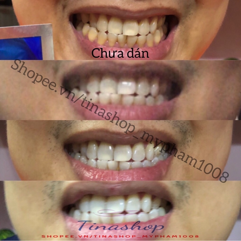 Combo 7 ngày miếng dán trắng răng Crest 3D White dành cho răng thường
