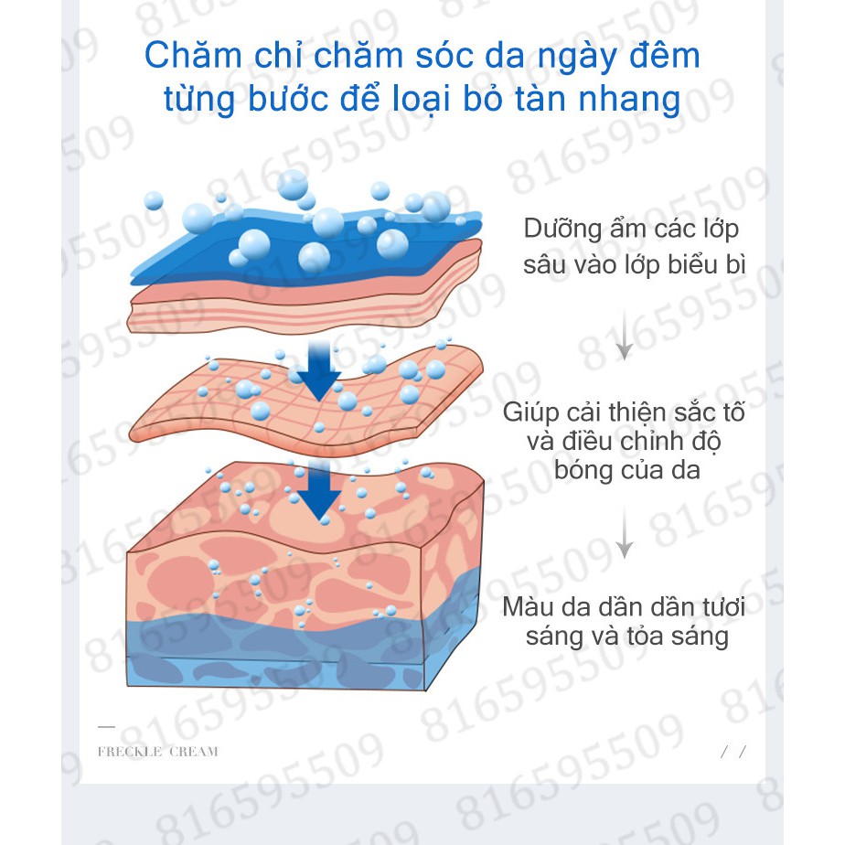 VENZEN Kem trị nám 50g Thích hợp cho các vết nám, tàn nhang, đốm thai kỳ, đốm nắng, đốm đen,  v.v.