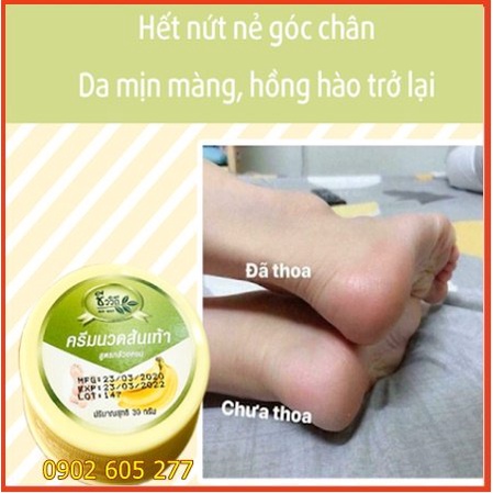 [hàng xịn]Kem Nứt Gót Chân BANANA CREAM HEEL Thái Lan