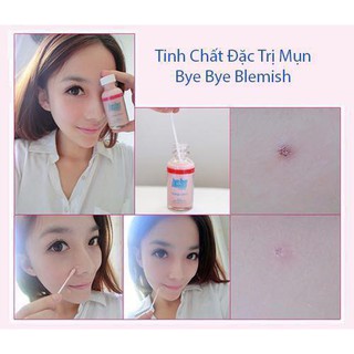 Lotion chấm mụn Bye Bye Blemish