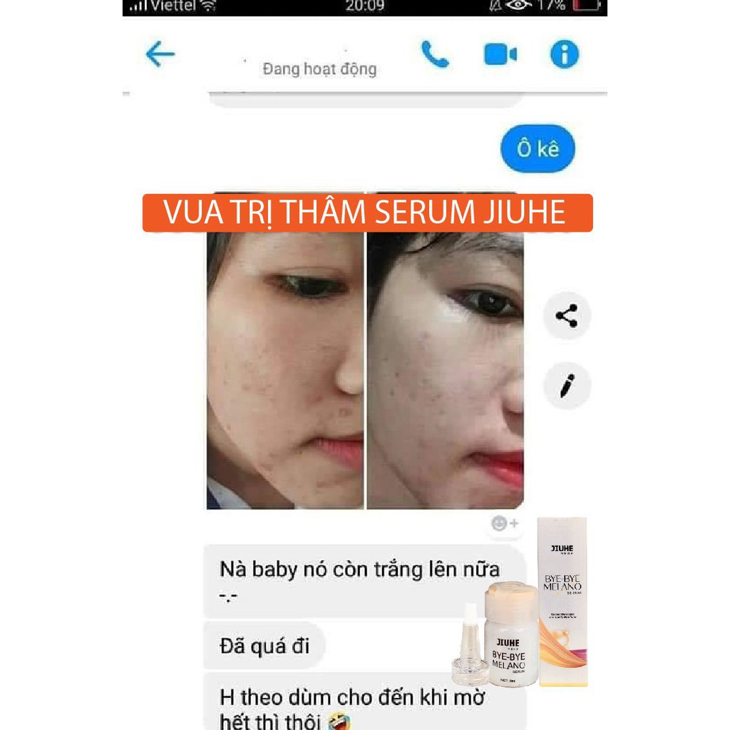 Serum tri thâm hàn quốc JIUHE Q-PEARL giảm thâm do mụn khửu tay chân, thâm sẹo, thâm nách hiệu quả | BigBuy360 - bigbuy360.vn