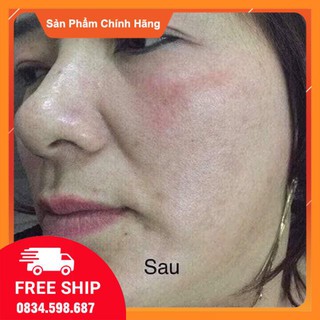 Bộ Meiya cam của Nhật