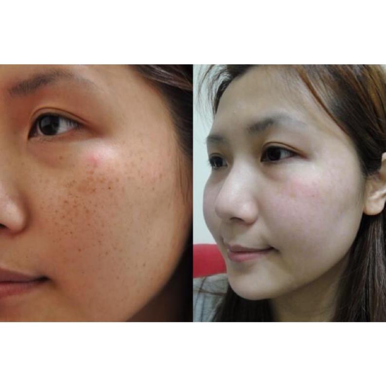 Serum Goodndoc Vitamin C 16.5 Mờ Nám Sáng Da Chống Lão Hoá 30ml