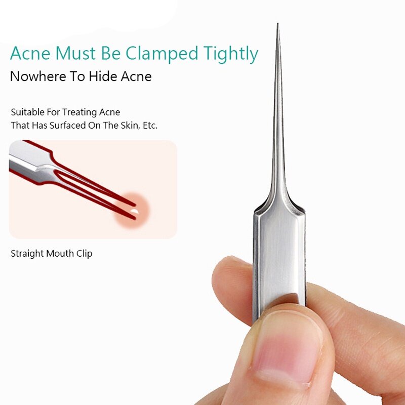 Nhíp Nặn Mụn Đầu Đen / Mụn Trứng Cá Hiệu Quả Tiện Lợi