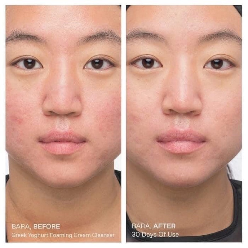 SỮA RỬA MẶT KORRES GREEK YOGHURT 150ML