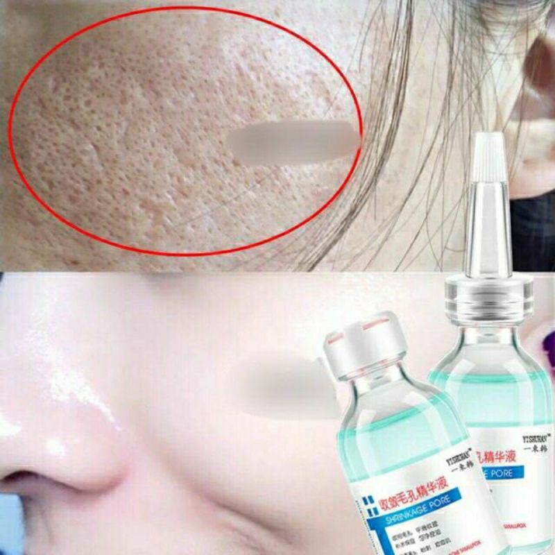 [RẺ VÔ ĐỊCH]Tinh Chất Shrinkage Pore Dưỡng Da Thu Nhỏ lỗ Chân Lông 30ml