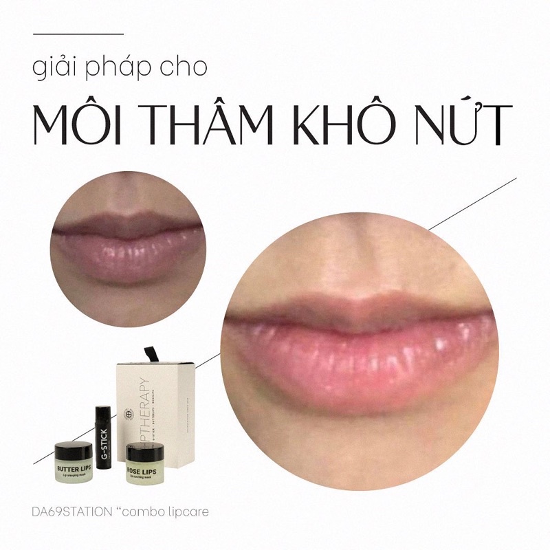 Combo giảm thâm môi LIPTHERAPY