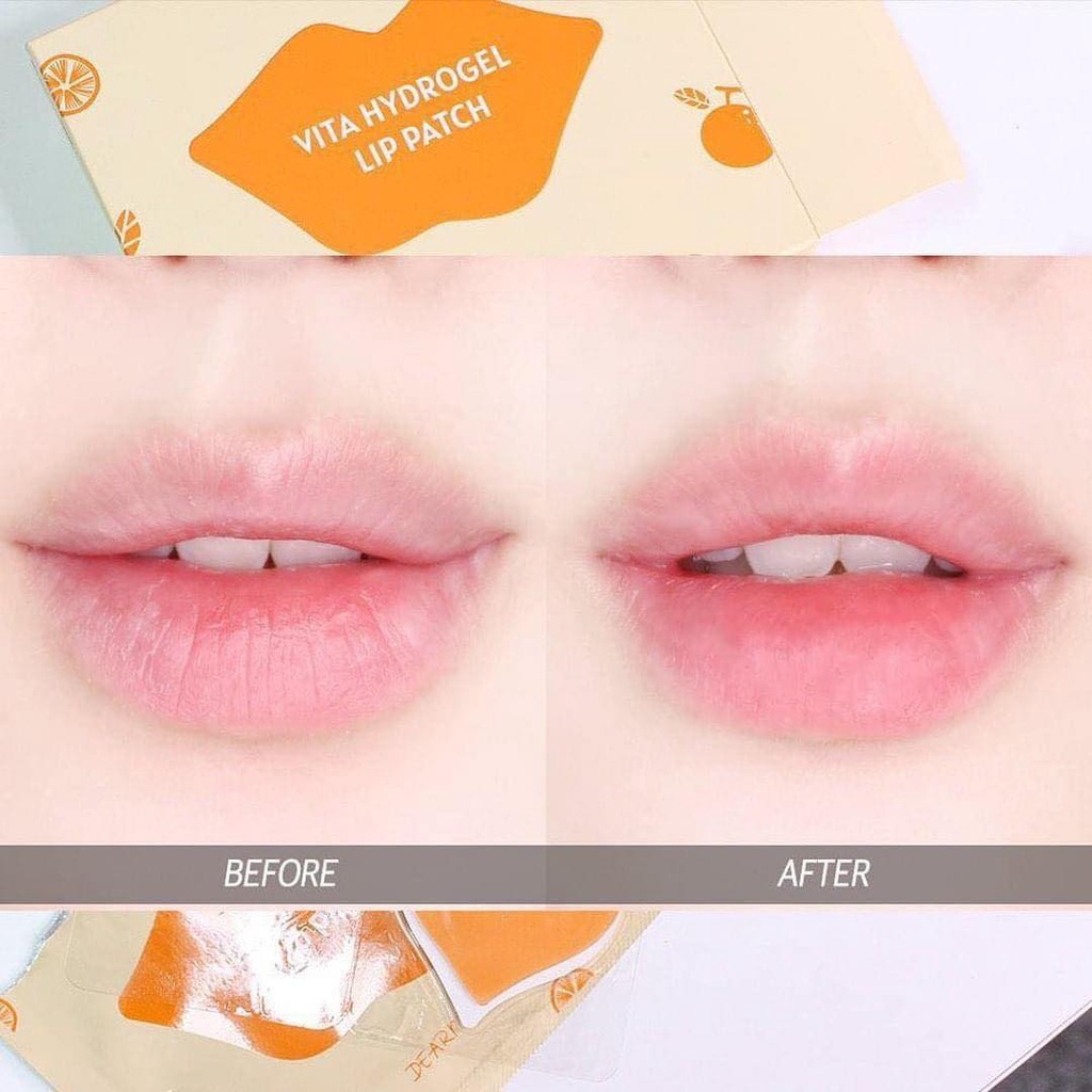 Mặt nạ môi Dearmay Vita Hydrogel Lip Patch