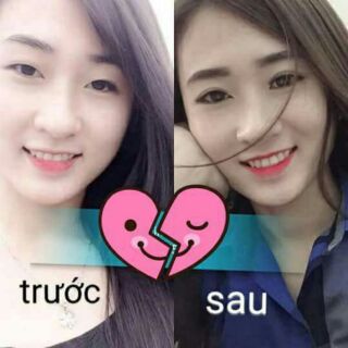 Miếng dán kích mí tàng hình Keli
