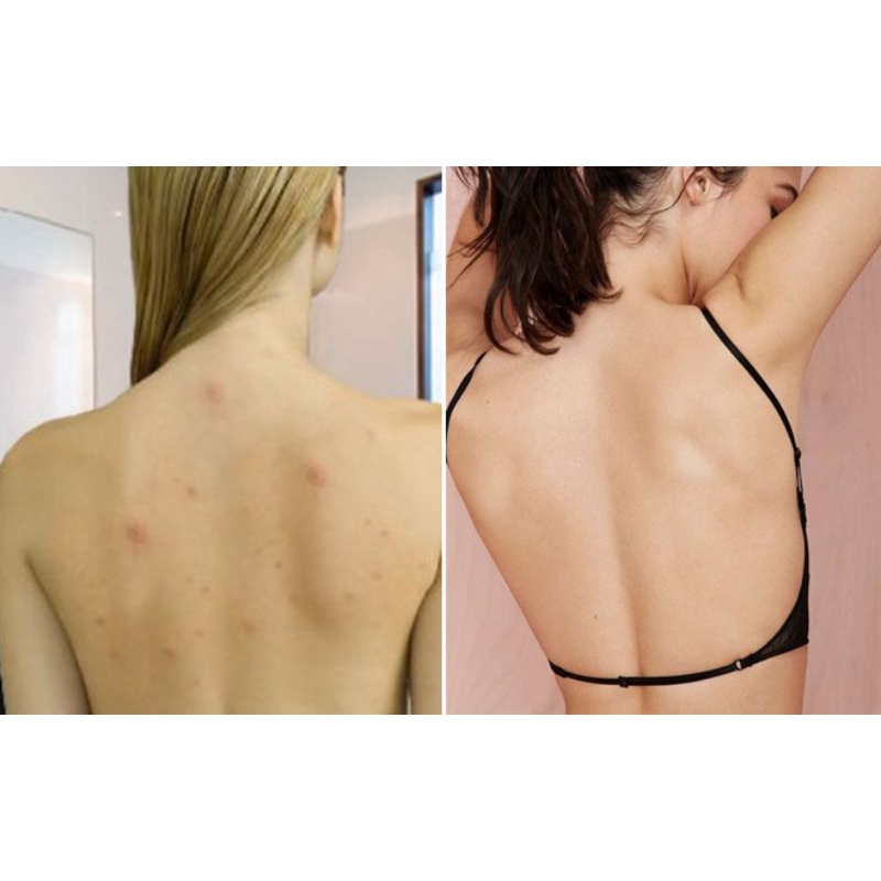 Hộp 500g Bột Thảo Mộc Tắm Trắng Da Body , Giảm mụn lưng, mịn màng sáng mướt.