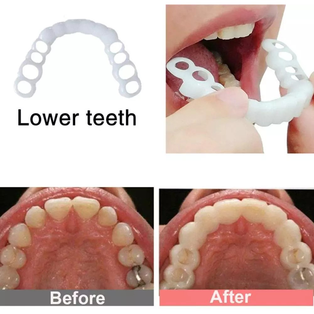 Sẵn sàng chuyển hàng Hot 2Pcs Perfect Smile Răng giả Che răng giả Răng giả Veneers Trắng răng trắng Răng chụp lại răng Chăm sóc răng giả thẩm mỹ