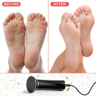 Máy chà gót chân điện tử