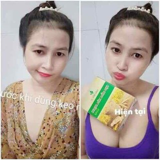 THẢO MỘC 37 kẹo mầm lúa mạch gold (tăng size vòng 1)