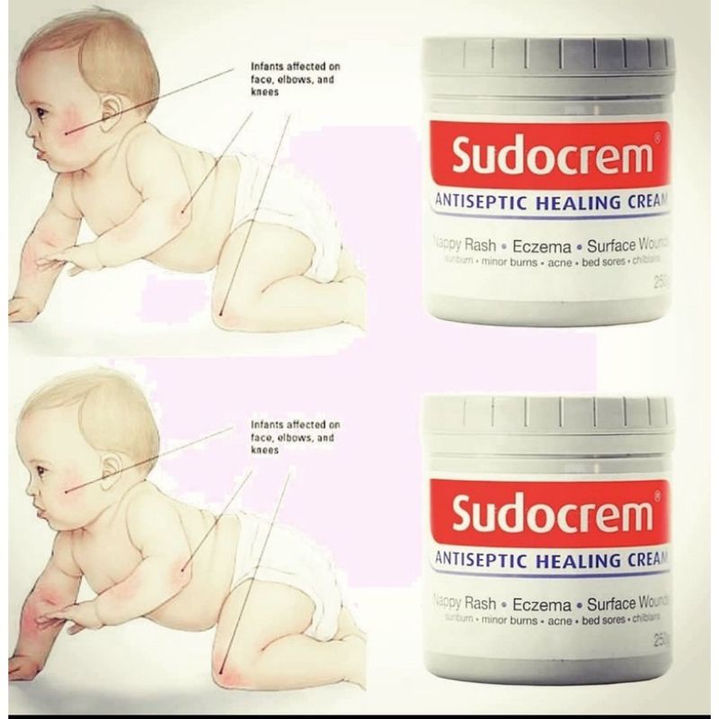 ⚡ Kem hăm Sudocrem 60g cho trẻ sơ sinh - Hàng UK