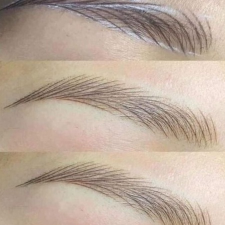 Máy Biomaser P70 dòng máy KTS đỉnh cao