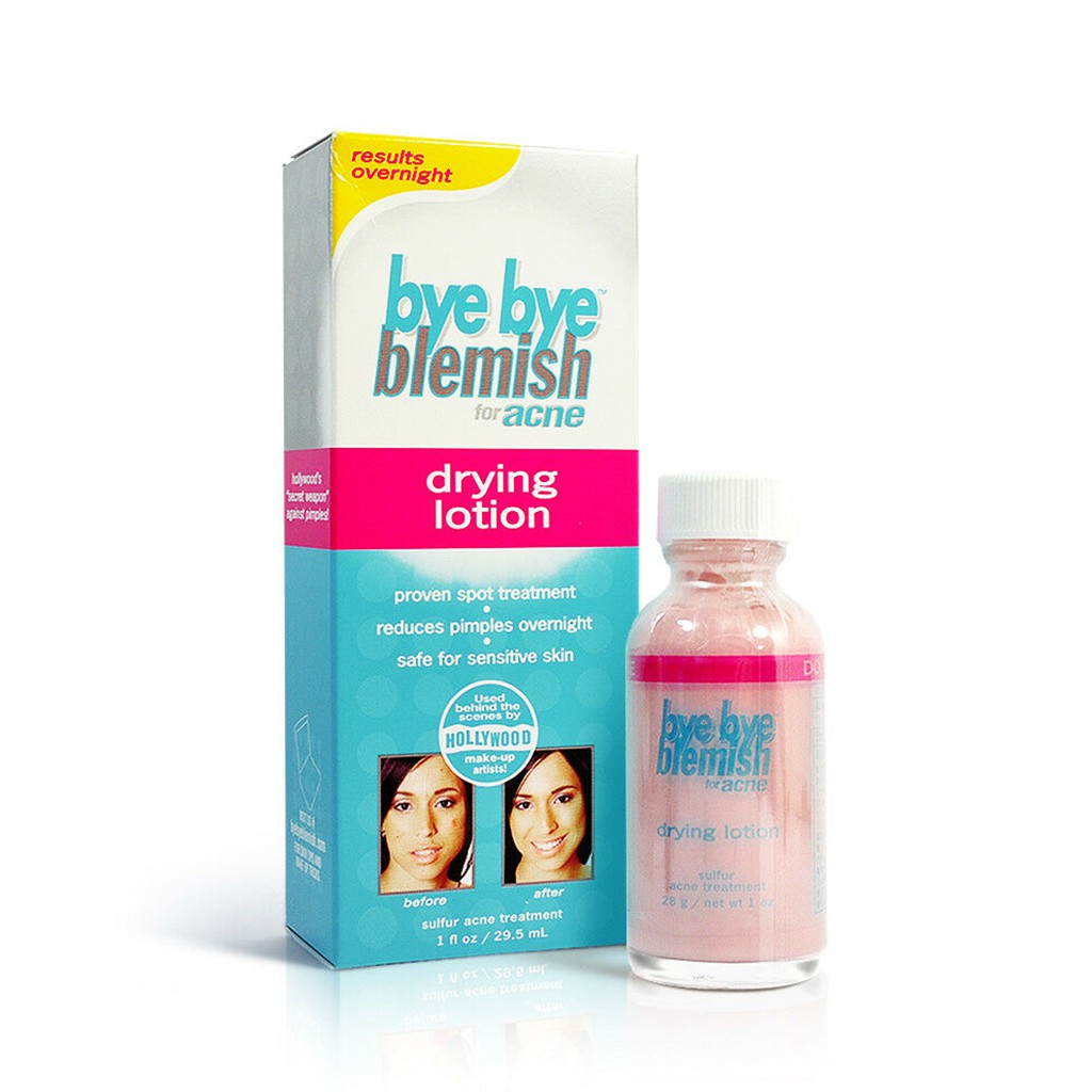 Kem Chấm Mụn Bye Bye Blemish Drying Lotion 30ml