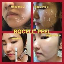Thay Da Sinh Học - Peel Da Vi Tảo Bqcell  2G
