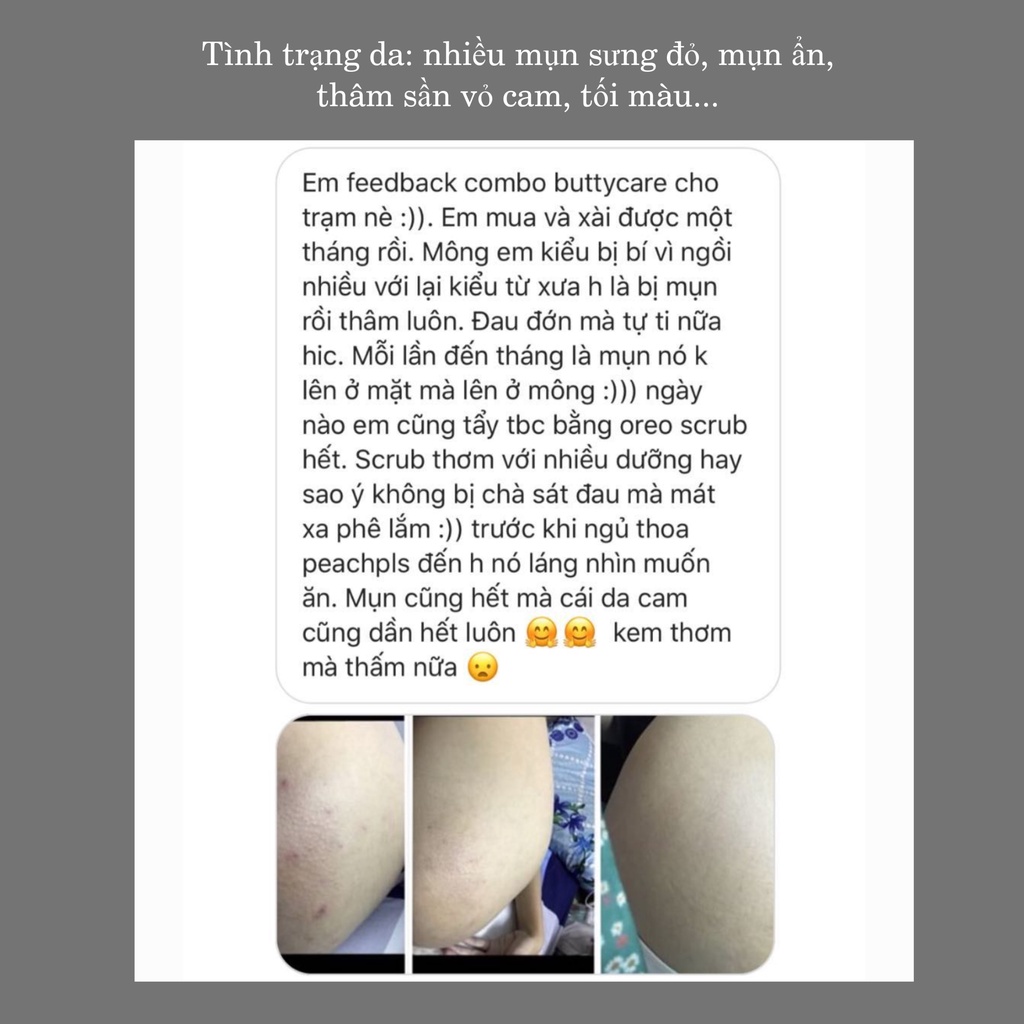Kem mờ thâm mông giảm mụn, sần vỏ cam, chai sần ngăn ngừa rạn PEACH PLS 50gr