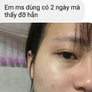 [Masa Đồng Nai]  DẦU CHÙM NGÂY MORIS 10ML