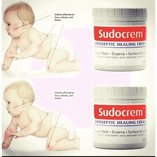 Kem Sudocrem