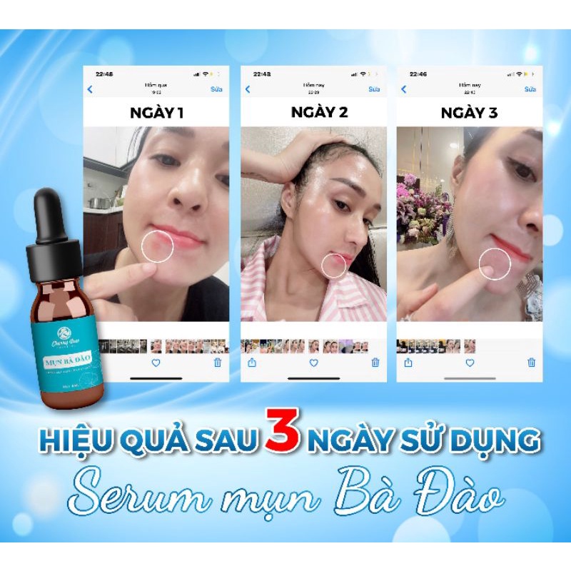 Mụn bọc, mụn mủ, mụn sưng, mụn đầu đen, mụn trứng cá....nói chung tất cả các loại mụn sẽ bỏ chạy khi gặp MỤN BÀ ĐÀO