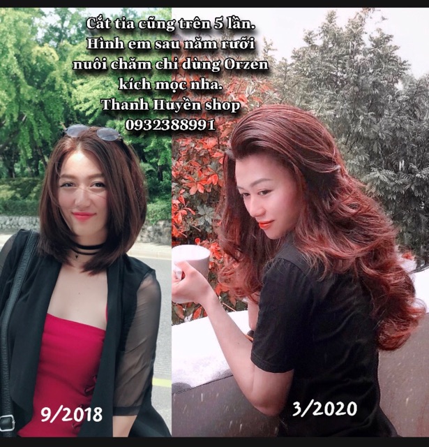 [CHÍNH HÃNG] : DẦU GỘI KÍCH THÍCH MỌC TÓC ORZEN HÀN QUỐC | BigBuy360 - bigbuy360.vn