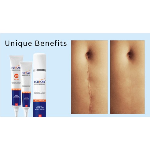 Forscar - sp chăm sóc sẹo được tin dùng tại châu Âu & Mỹ