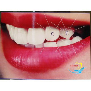 [FREESHIP] BỘ 5 HẠT ĐÍNH ĐÁ TRÊN RĂNG (HẠT+KEO) [HCM]