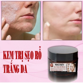 Kem xóa sẹo rỗ macoizy dưỡng trắng hết thâm