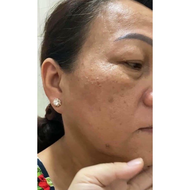 Kem tái tạo chamomile