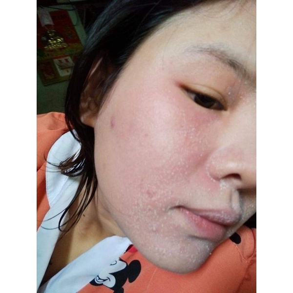 Kem Tái Tạo Da   My My T&M 20 gam tặng kích bong