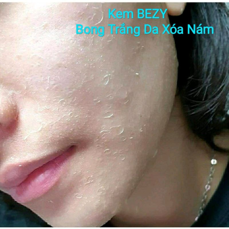 Kem Bong Da Mặt Trắng Da Mờ Thâm Nám