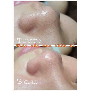 Nhíp Gắp Mụn VACOSI T07