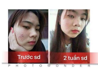 FACE XANH ZQLEY