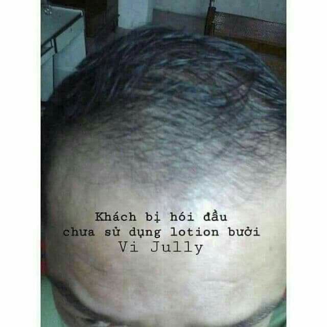 Tinh Dầu Bưởi Vi Jully 100% Thiên Nhiên Giúp Tóc Nhanh Dài, Mọc Tóc Nhanh