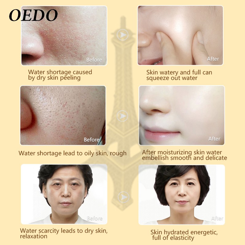 Serum Dưỡng Sáng Sâu OEDO Dưỡng Ẩm Phục Hồi Làm Trắng Sáng Da Cấp Nước Chống Lão Hóa Natural Skin Cho Mọi Loại Da 15ml