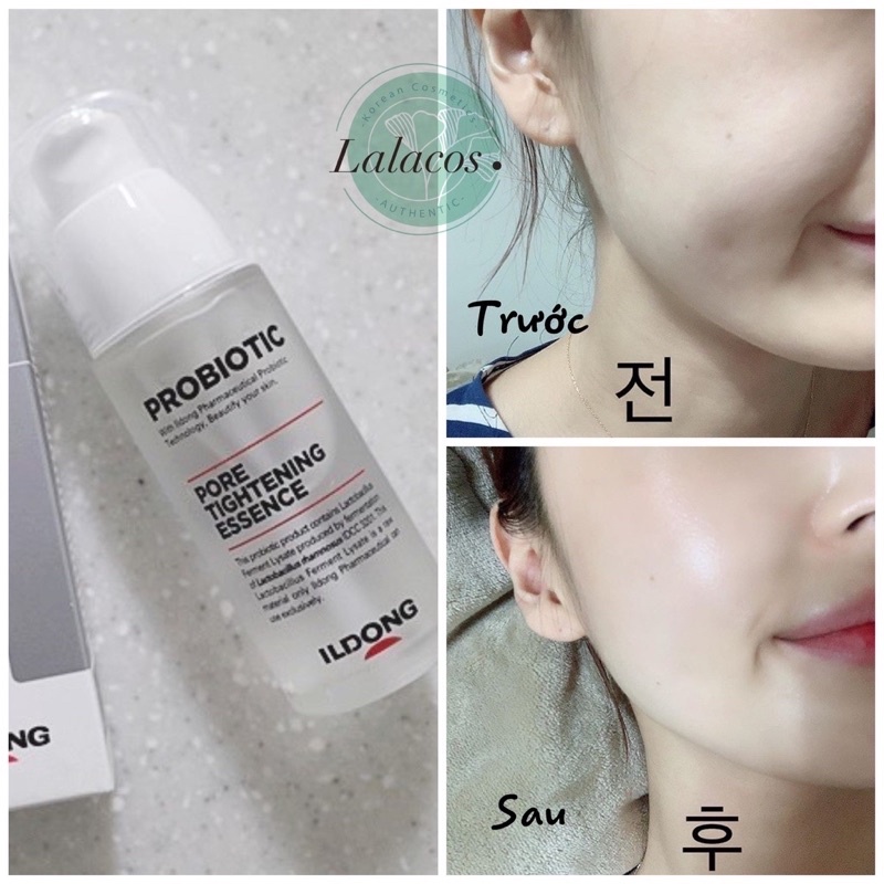 Tinh chất men vi sinh ildong se khít lỗ chân lông