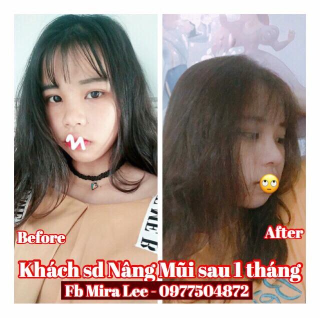 Serum Nâng Cao Mũi Hàn