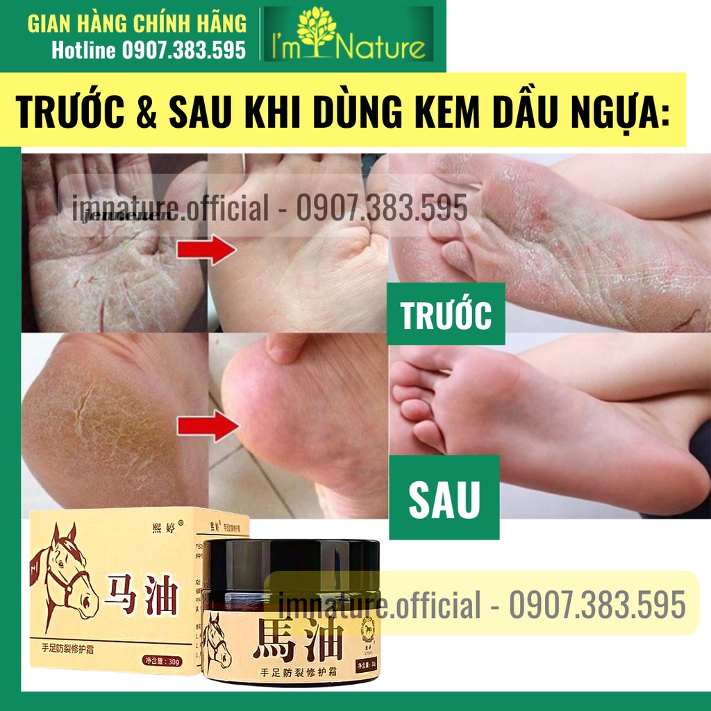 Kem Dầu Ngựa Dưỡng Ẩm Da Tay Da Chân Chống Khô Nẻ 30gr
