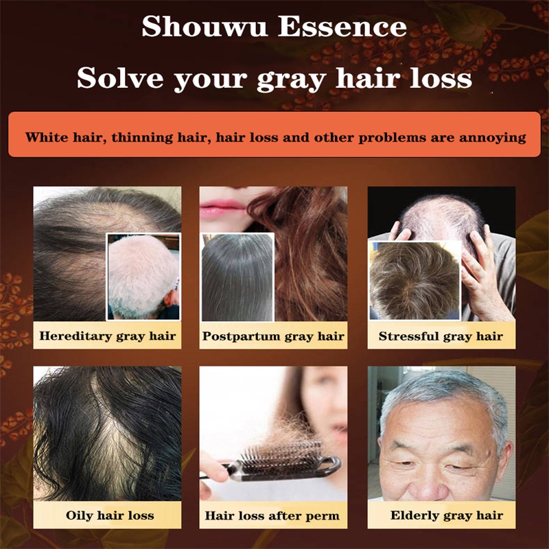 Tinh chất đen tóc Dầu dưỡng tóc ủ tóc phục hồi hư tổn serum dưỡng tóc dầu xả tóc Xịt tóc đen xịt mọc tóc 100ml | BigBuy360 - bigbuy360.vn