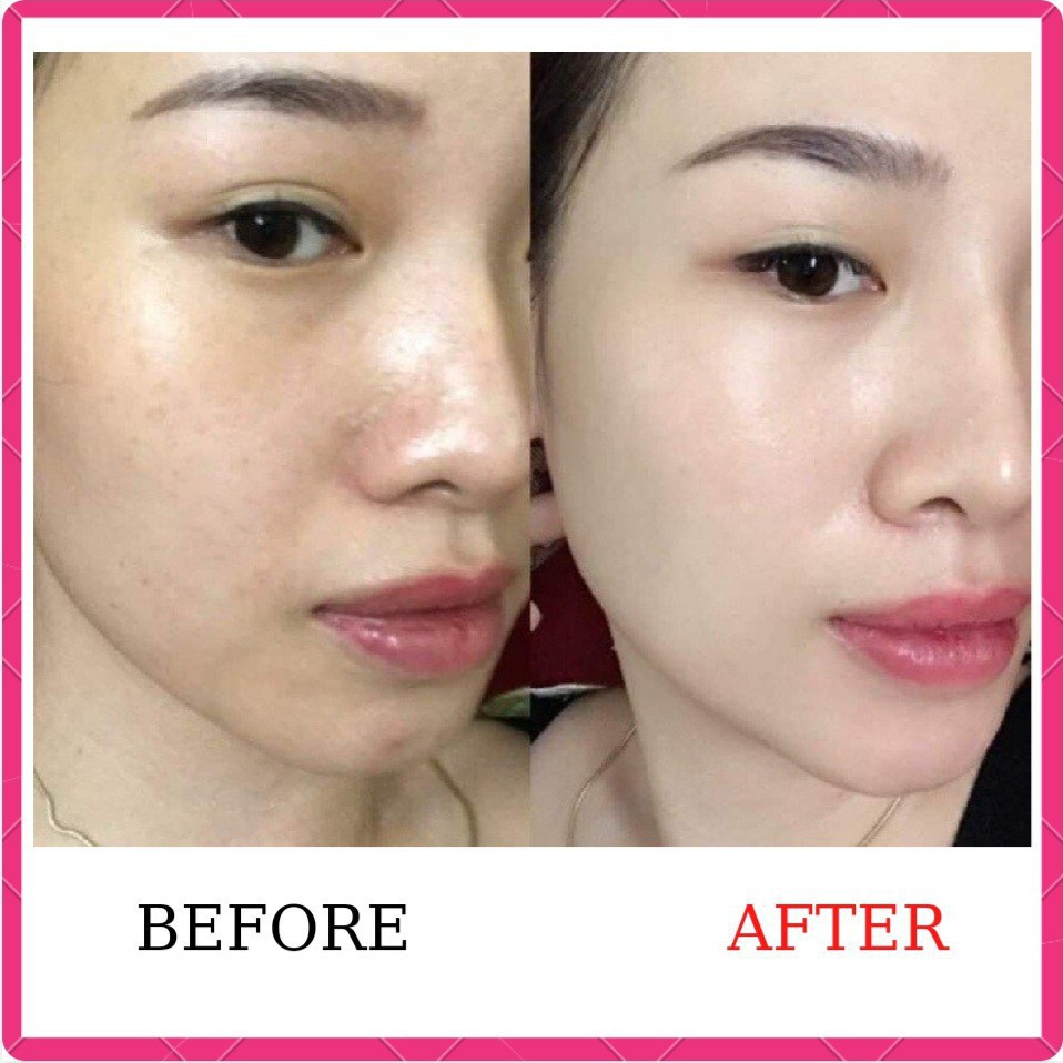 [KOREA] Kem Dưỡng Da Chống Lão Hoá Phục Hồi Da Mặt Chuyên Sâu Hàn Quốc Tái Tạo, Mờ Thâm Green Natural Seed The Face Shop | BigBuy360 - bigbuy360.vn