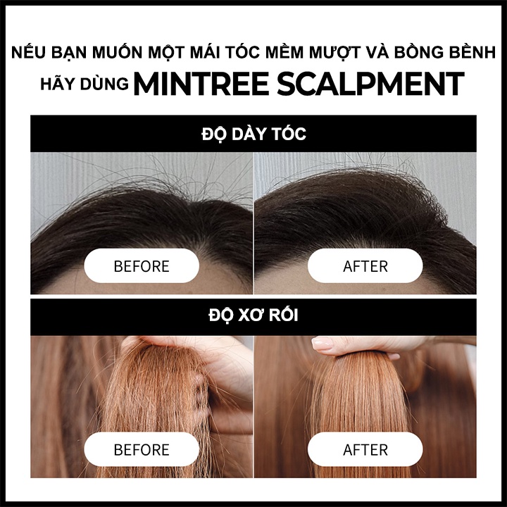 Kem Ủ Và Xả Chăm Sóc Tóc Toàn Diện Mintree Hair Balancing Scalpment 200ml - K2V Shop