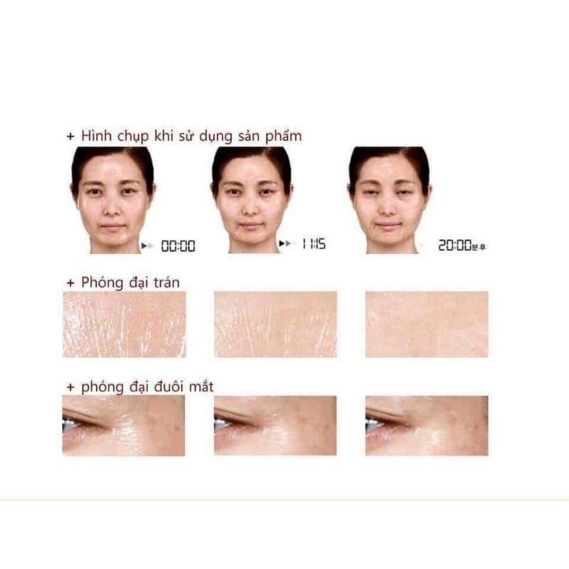 Gel Nâng Cơ Xóa Nhăn CareCella Facial line up lifting gel 1 hộp/4 gói x 9ml, tuyển sỉ, CTV IB